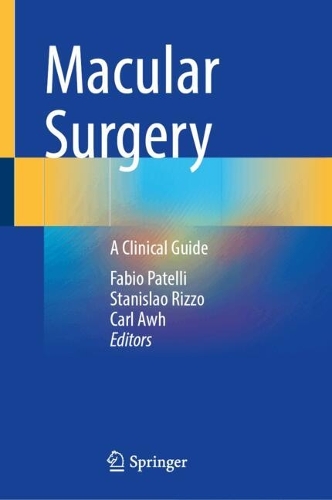 Macular Surgery