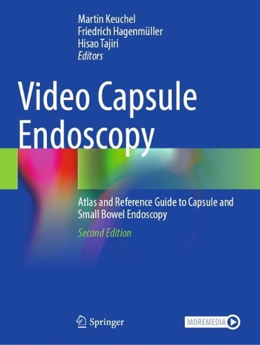 Video Capsule Endoscopy