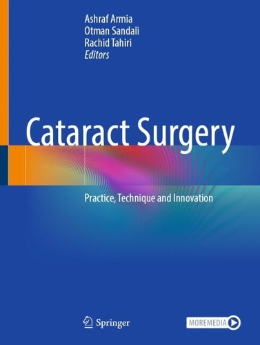 Cataract Surgery