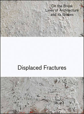 Displaced Fractures