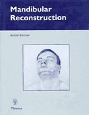 Mandibular Reconstruction