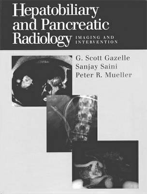 Hepatobiliary and Pancreatic Radiology
