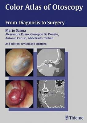 Color Atlas of Otoscopy