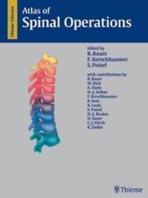 Atlas of Spinal Operations