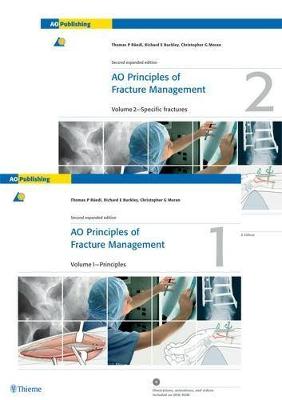 AO Principles of Fracture Management