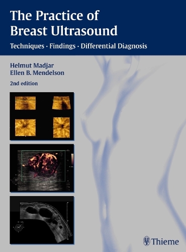 The Practice of Breast Ultrasound