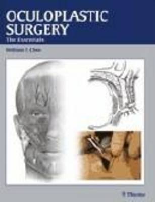 Oculoplastic Surgery