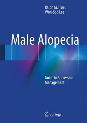 Male Alopecia