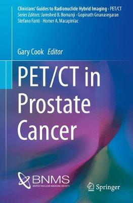 PET/CT in Prostate Cancer