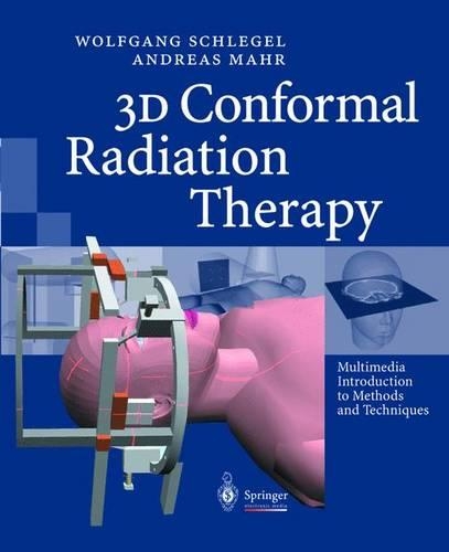 3D Conformal Radiation Therapy
