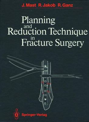 Planning and Reduction Technique in Fracture Surgery