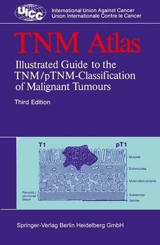TNM Atlas