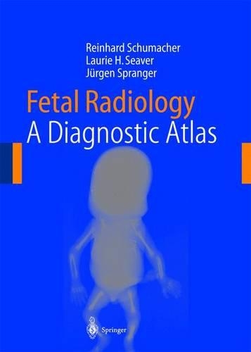Fetal Radiology