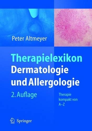 Therapielexikon Dermatologie Und Allergologie