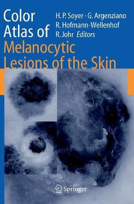 Color Atlas of Melanocytic Lesions of the Skin