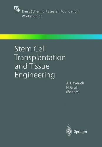 Stem Cell Transplantation and Tissue Engineering