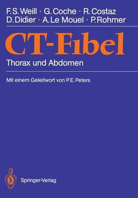 CT-Fibel