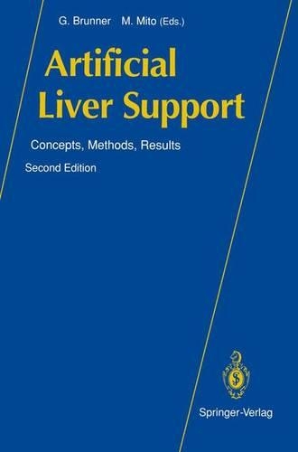 Artificial Liver Support