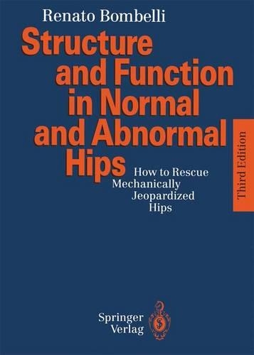 How to Rescue Mechanically Jeopardized Hips