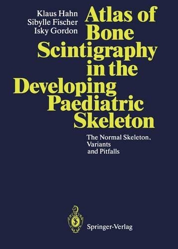 Normal Skeleton, Variants and Pitfalls