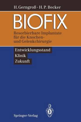 BIOFIX