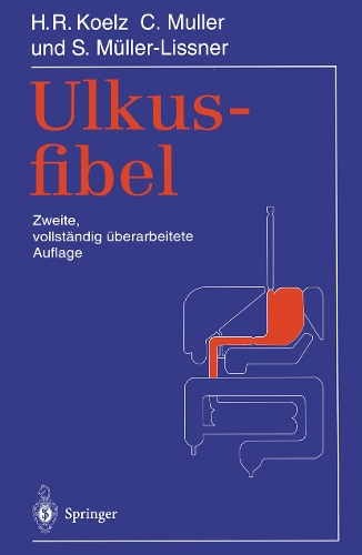 Ulkusfibel