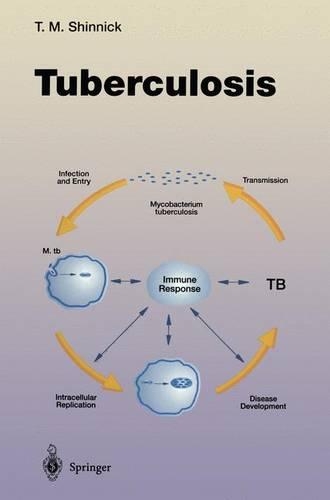 Tuberculosis