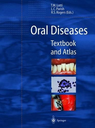 Oral Diseases