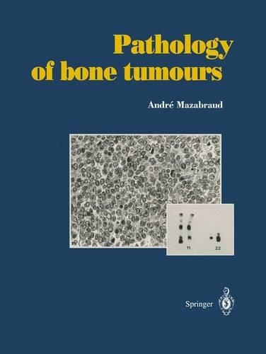 The Pathology of Bone Tumors
