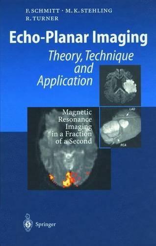 Echo-Planar Imaging