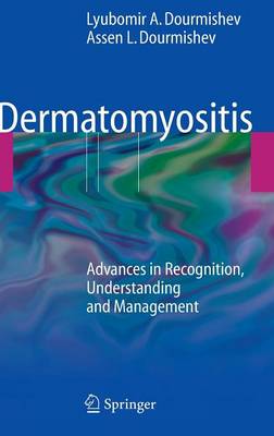 Dermatomyositis