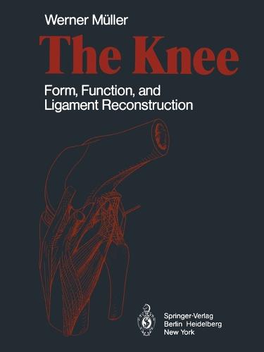 The Knee