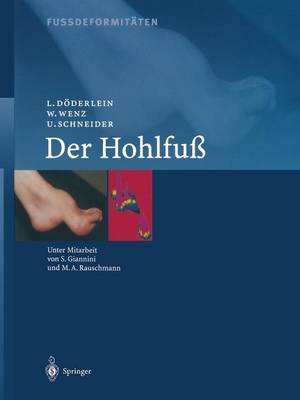 Fussdeformitäten