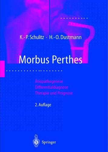 Morbus Perthes