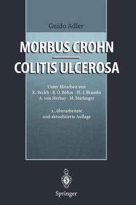 Morbus Crohn - Colitis ulcerosa