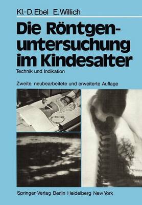 Die Röntgenuntersuchung im Kindesalter