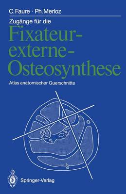 Zugänge für die Fixateur-externe-Osteosynthese