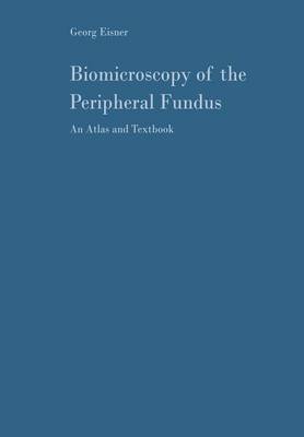 Biomicroscopy of the Peripheral Fundus