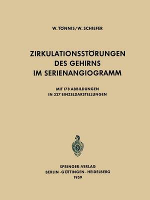 Zirkulationsstörungen des Gehirns im Serienangiogramm