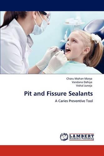 Pit and Fissure Sealants