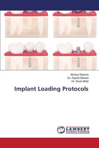 Implant Loading Protocols