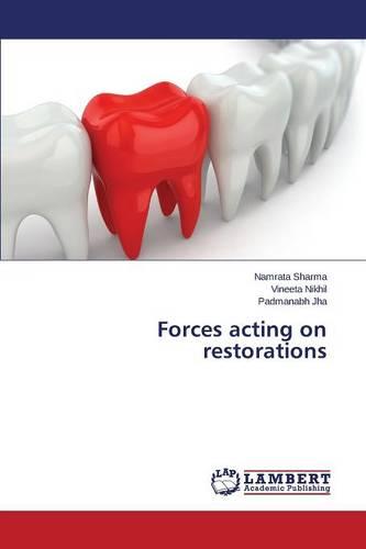 Forces Acting on Restorations