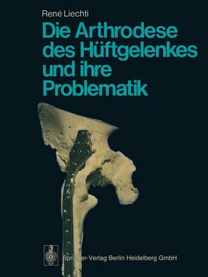 Die Arthrodese des Hüftgelenkes und ihre Problematik