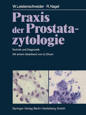 Praxis der Prostatazytologie