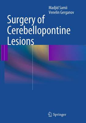 Surgery of Cerebellopontine Lesions