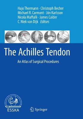 The Achilles Tendon