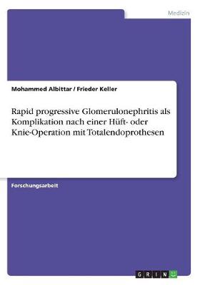Rapid Progressive Glomerulonephritis ALS Komplikation Nach Einer H ft- Oder Knie-Operation Mit Totalendoprothesen