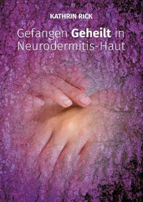 Gefangen Geheilt in Neurodermitis-Haut
