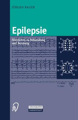 Epilepsie
