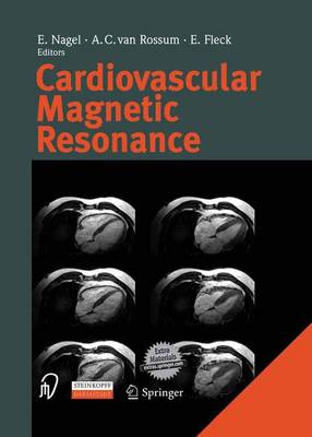 Cardiovascular Magnetic Resonance